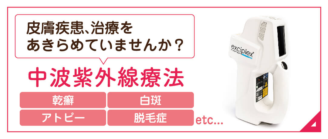 中波紫外線療法|詳しくはこちら